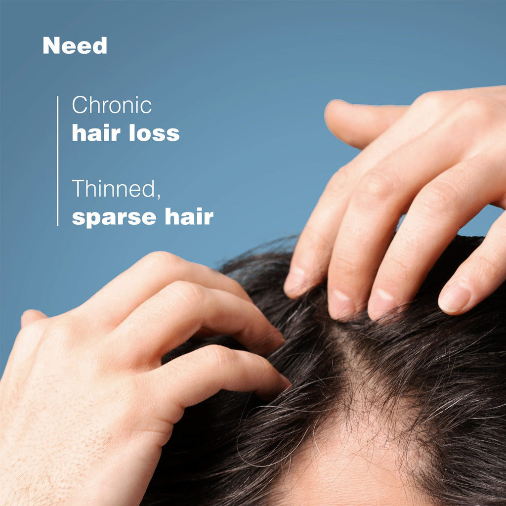 ANAPHASE Complement Shampoo Anti-Hair Loss