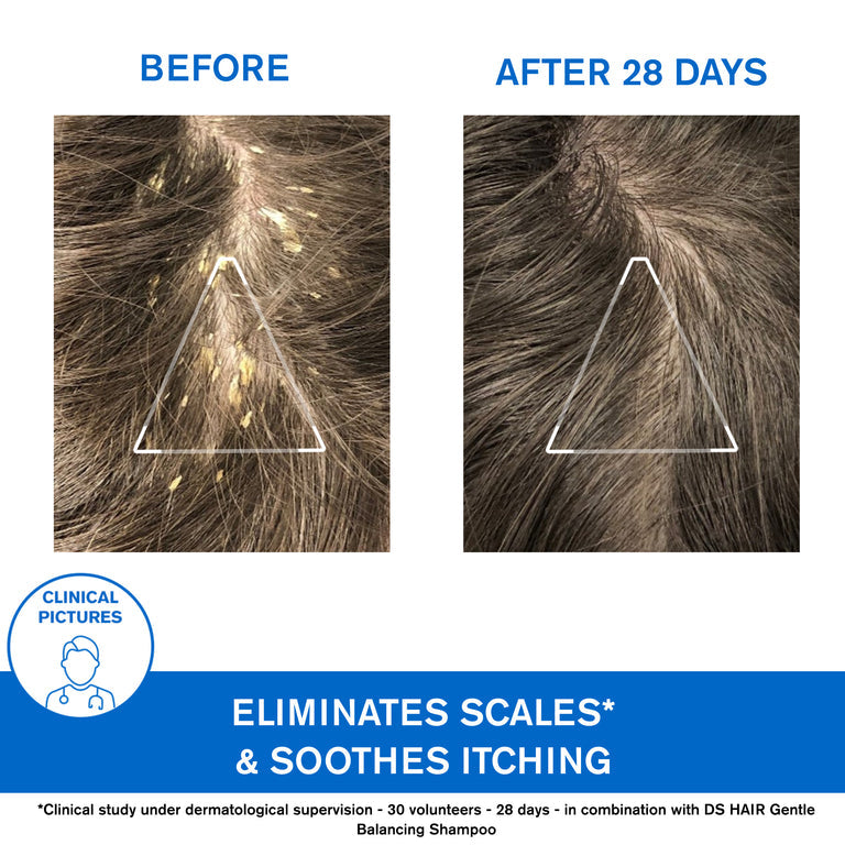 DS Kerato-Reducing Treatment Shampoo