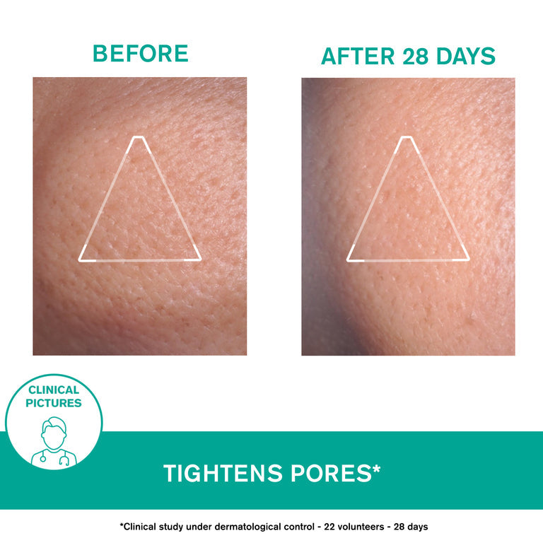 Hyséac Mat Mattifying Emulsion
