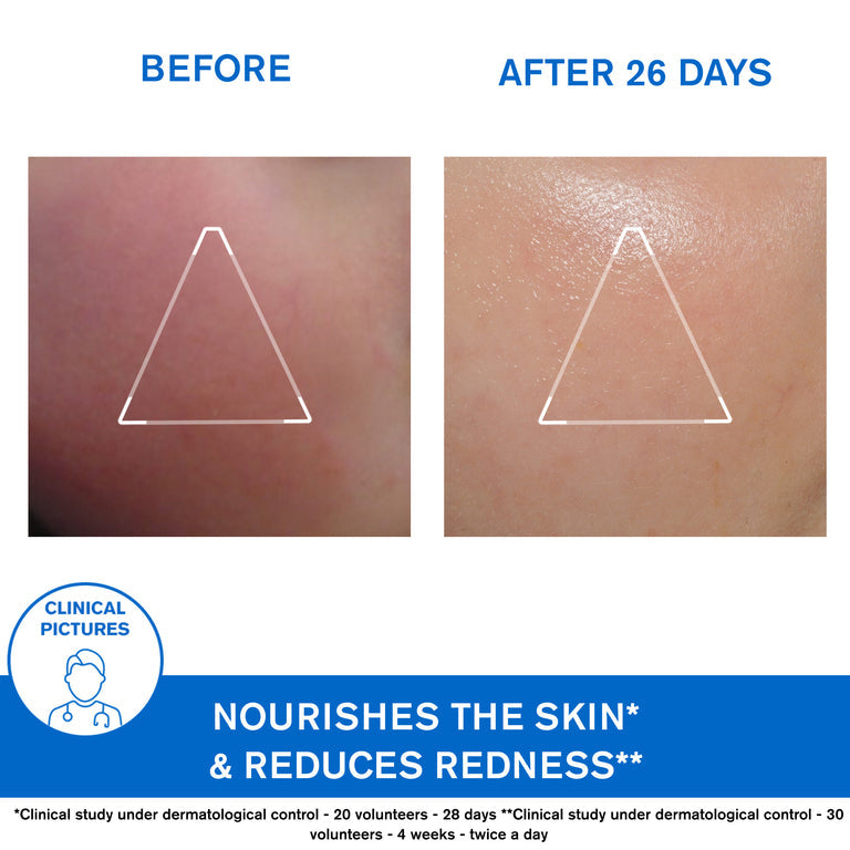 Xémose Face Cream