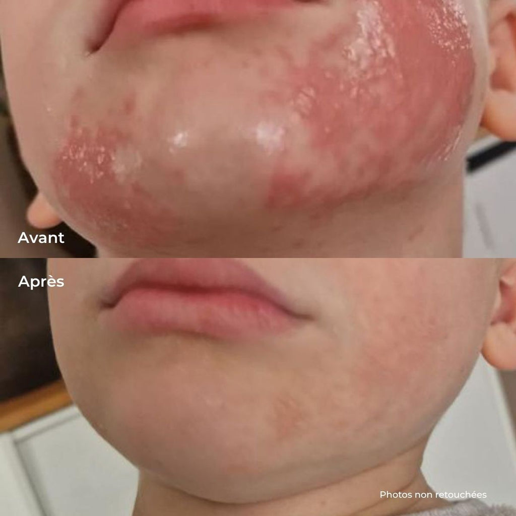 Multi-Use Orange Blossom Magic Balm