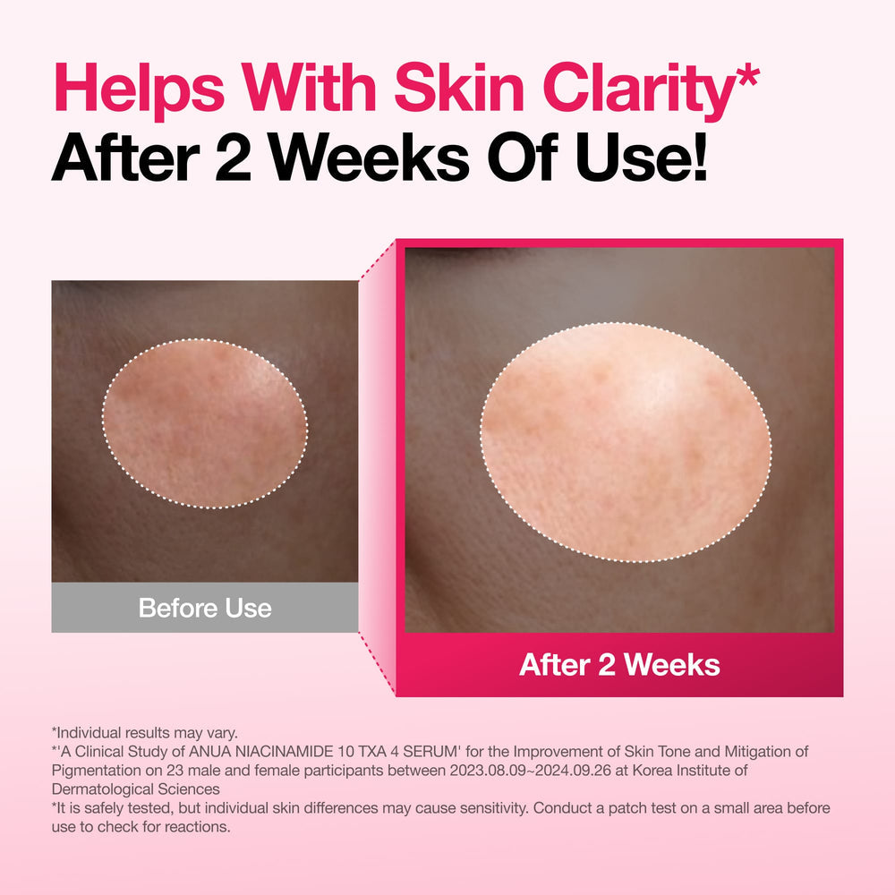 Niacinamide 10% TXA 4%