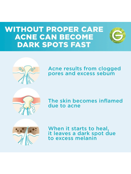 Fast Clear Booster Serum with Salicylic Acid