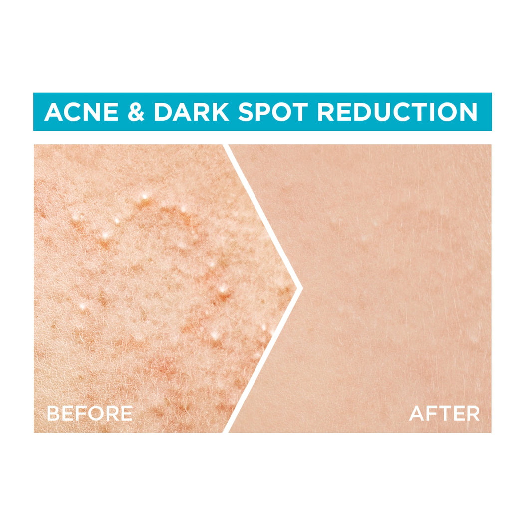 Fast Clear Booster Serum with Salicylic Acid