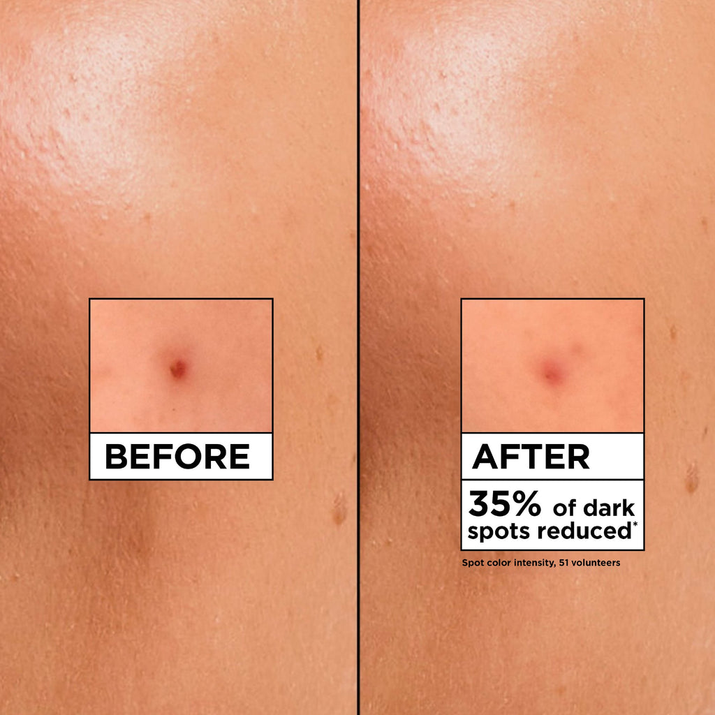 Vitamin C Fresh & Matte Hydrating Sorbet Cream