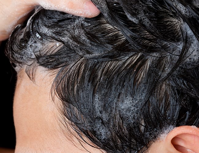 Scalp Solution Anti-Dandruff Shampoo