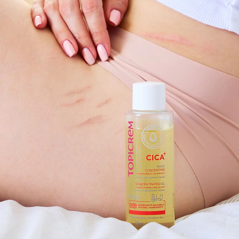CICA+ Concentrated Oil for Stretch Marks