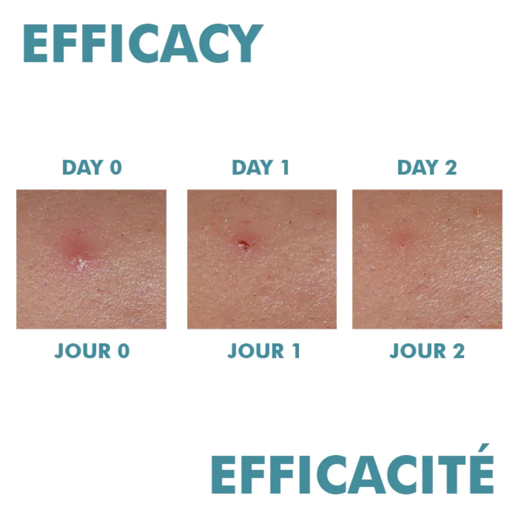 CLEANANCE Comedomed Peeling Intensive Cream
